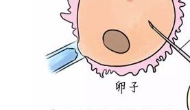 昆明比较好的第二代试管婴儿医院是哪家医院？成功率如何？