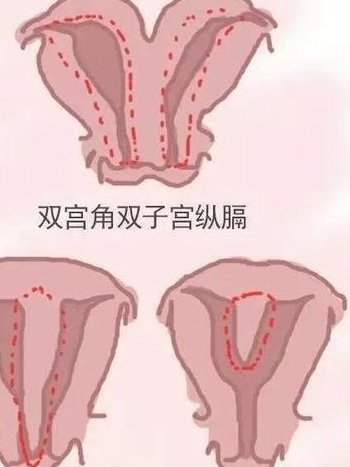吉林省人民医院试管婴儿成功率多少？