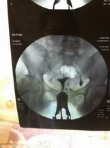 2026南昌人工授精生孩子医院排名，附试管成功率、费用