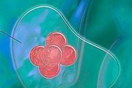 做试管hcg翻倍不好怎么办？还能保胎吗？